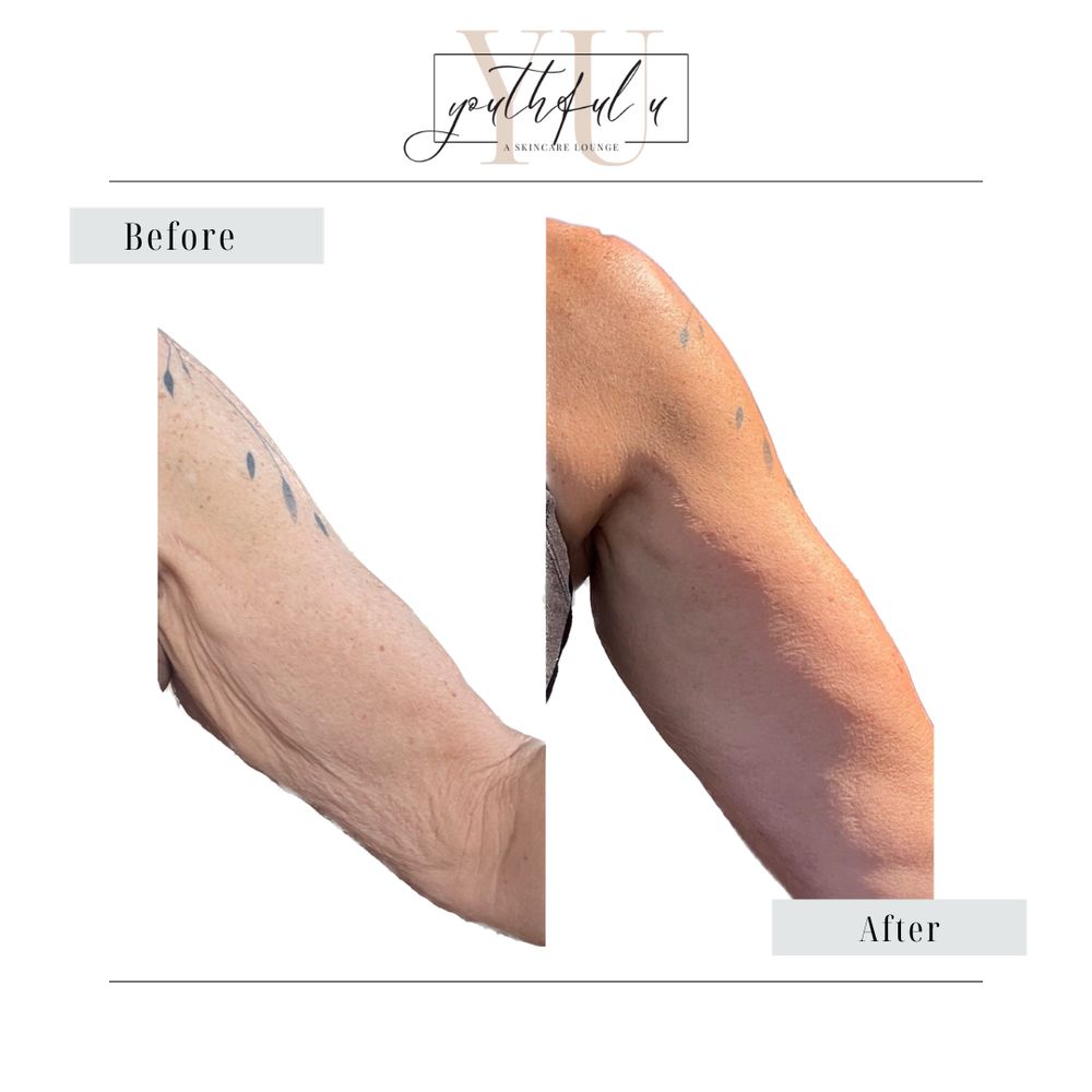 YOUTHFUL U Request an Appointment San Clemente, California Skin