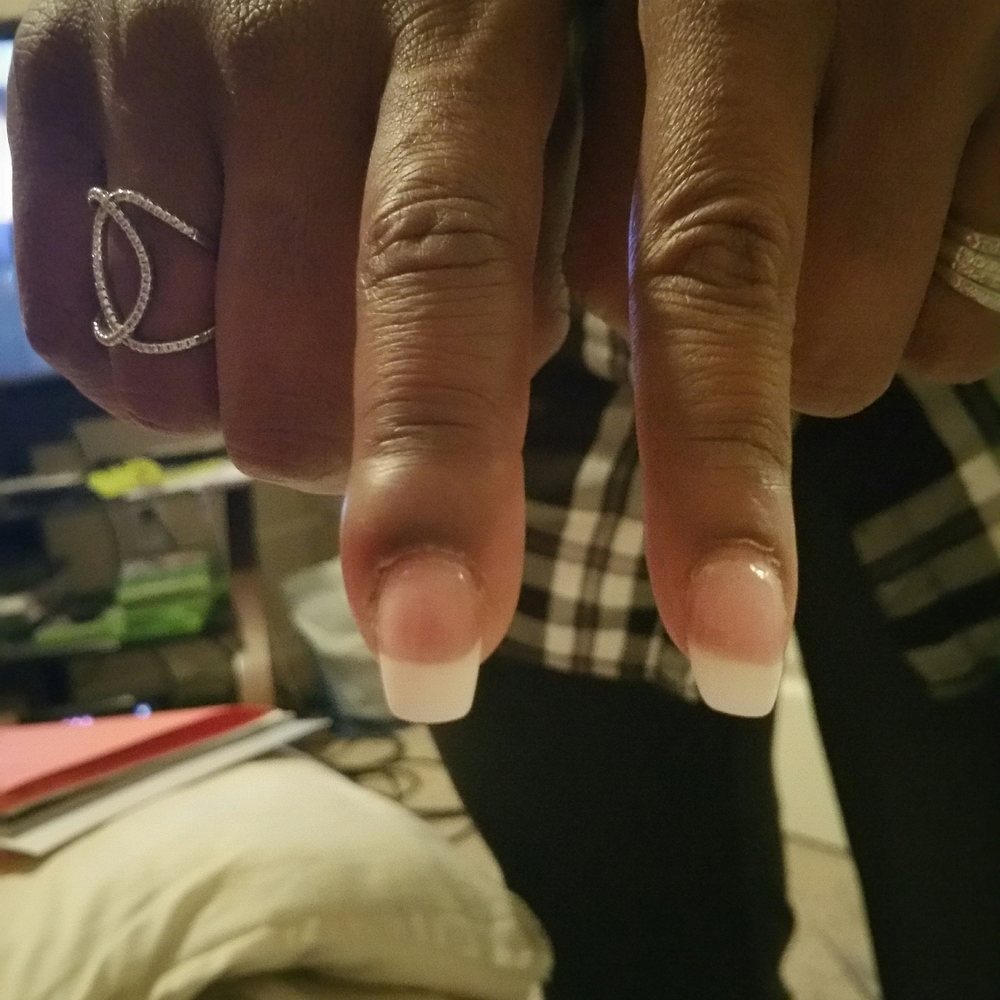 This is my finger on Monday and Tuesday after nails done on Dec 2nd. This is my finger on Monday and Tuesday after nails done on Dec 2nd.