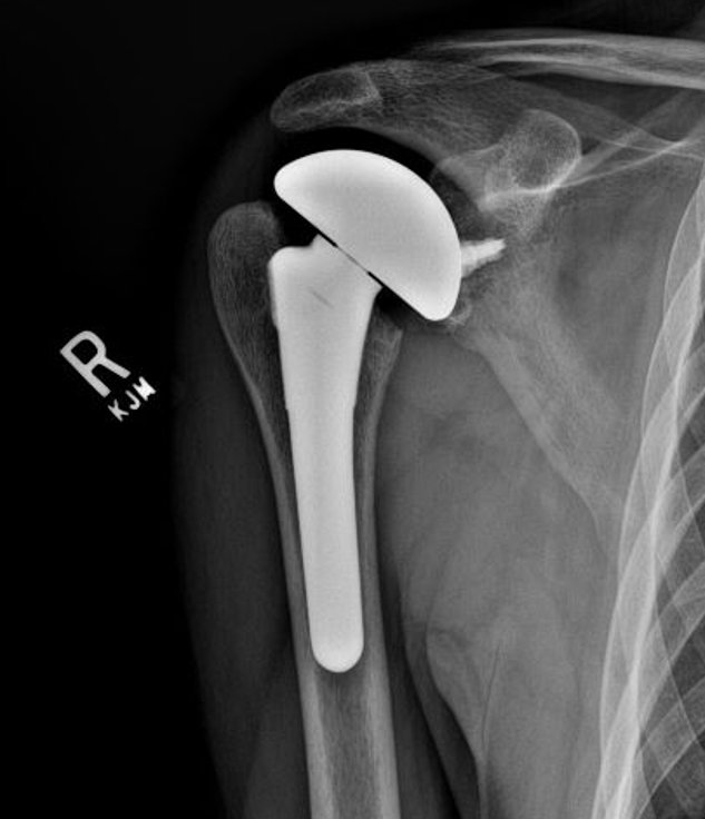 M. Tyrrell Burrus, MD - patient advocate in Austin, TX