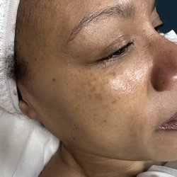 Reje Aesthetics - Glow facial