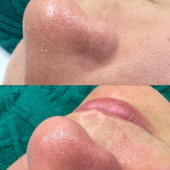 Dermavip - Estheticians Near Me - Concord, California