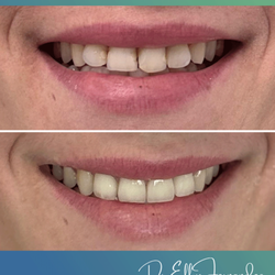 Jade Dental Palm Beach