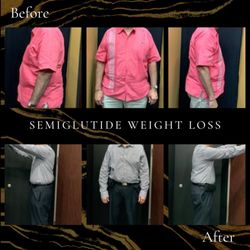 Naz Keshwani, M.D - Elite Doc Health and Beauty - Semaglutide weightloss program before and after results
