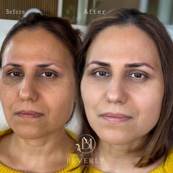 Beverly Microblading Center - Eyebrow Microblading before|After done by Master Artist Mahsa Bahaelou - Permanent Makeup Near Me - Los Angeles, California Beverly Microblading Center - Eyebrow Microblading before|After done by Master Artist Mahsa Bahaelou - Permanent Makeup Near Me - Los Angeles, California