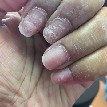 Tiffany's Nails - Nails ripped off - Nail Salons Near Me - Stone Mountain, Georgia Tiffany's Nails - Nails ripped off - Nail Salons Near Me - Stone Mountain, Georgia