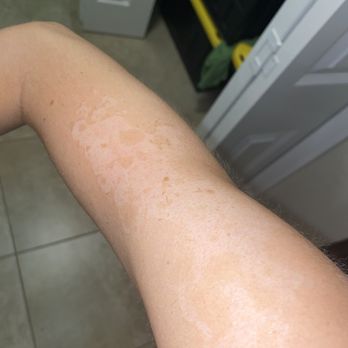 Tan USA - My upper right arm - Tanning Near Me - Cape Coral, Florida Tan USA - My upper right arm - Tanning Near Me - Cape Coral, Florida