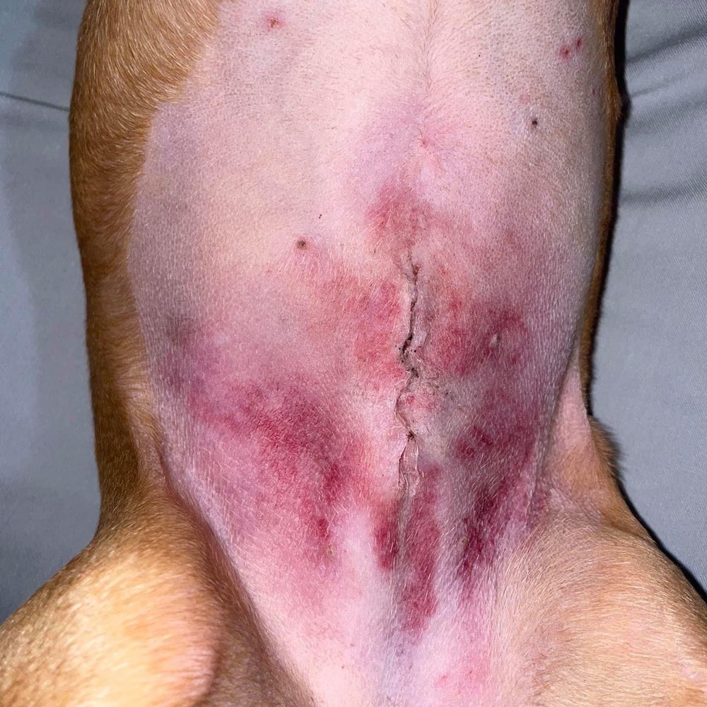 Post unauthorized/ negligent surgery. Look at all the bruising. This on a dog who was already spayed. Post unauthorized/ negligent surgery. Look at all the bruising. This on a dog who was already spayed.