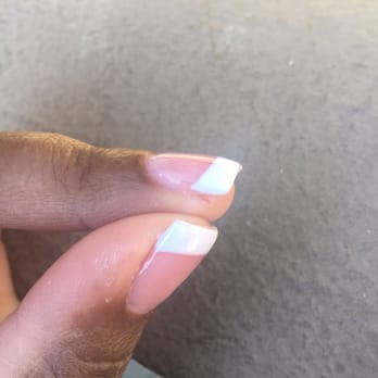 Tip Top Nail Bar - A slit in my skin that burns like crazy. - Nail Salons Near Me - Tustin, California Tip Top Nail Bar - A slit in my skin that burns like crazy. - Nail Salons Near Me - Tustin, California