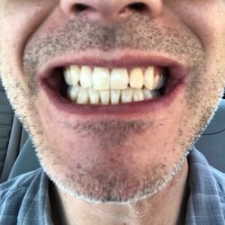 Mortenson Family Dental - An excellent deep cleaning