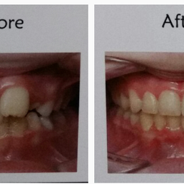 My son's before and after My son's before and after