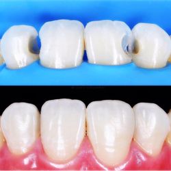 Park Avenue Cosmetic Dentistry and Implant Center - The art of dentistry :)