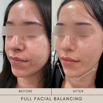 Balance Lab Aesthetics - Medical Spas Near Me - La Habra, California Balance Lab Aesthetics - Medical Spas Near Me - La Habra, California