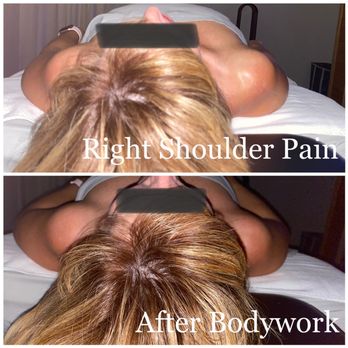 Back N Motion Advanced Bodywork - Shoulder pain - Massage Therapy Near Me - Temple, Texas Back N Motion Advanced Bodywork - Shoulder pain - Massage Therapy Near Me - Temple, Texas