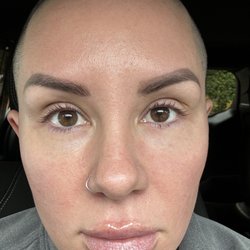 My PRF journey