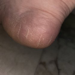 Forum Nails Spa - This is right after a pedicure, still all calloused, cracked and dry. Which is why I went for a pedicure.