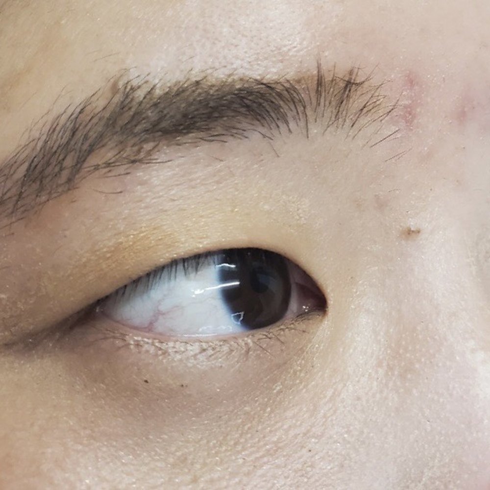 Before