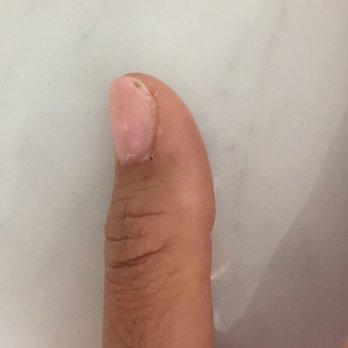 La Mode Nails & Spa - Cracked after a day. SNS Powdered nail. Had them redone and they look a lot smoother. - Nail Salons Near Me - Austin, Texas La Mode Nails & Spa - Cracked after a day. SNS Powdered nail. Had them redone and they look a lot smoother. - Nail Salons Near Me - Austin, Texas