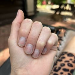 Pure Spa - My damaged nails