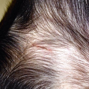 A Dog's Day Out - Ashburn - The scratch on my puppy's inner thigh area - Pet Groomers Near Me - Ashburn, Virginia