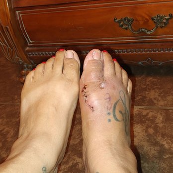 Ben Wehrli DPM - Look at the difference - Podiatrists Near Me - Palm Desert, California Ben Wehrli DPM - Look at the difference - Podiatrists Near Me - Palm Desert, California