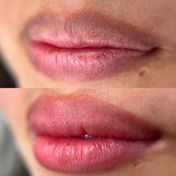 Kahena Beauty - Before and after lip neutralization