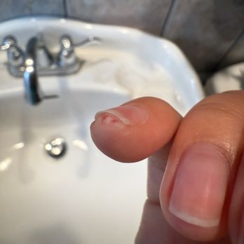 Topline Nails and Lashes - Popped blister - Nail Salons Near Me - Pico Rivera, California Topline Nails and Lashes - Popped blister - Nail Salons Near Me - Pico Rivera, California
