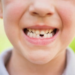 Mosier Brian, DDS