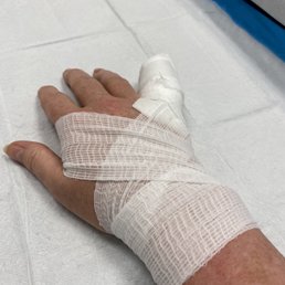 Injured