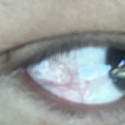 75 day facial face was so oily eyes were burning smells no good