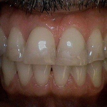 Adriana Barrera, DDS - Barrera Advanced Dentistry - Cosmetic Dentists Near Me - Torrance, California Adriana Barrera, DDS - Barrera Advanced Dentistry - Cosmetic Dentists Near Me - Torrance, California