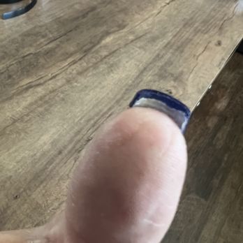 V.T Nail Spa & Lashes - My real nail underneath completely trashed - Nail Salons Near Me - Pueblo, Colorado V.T Nail Spa & Lashes - My real nail underneath completely trashed - Nail Salons Near Me - Pueblo, Colorado