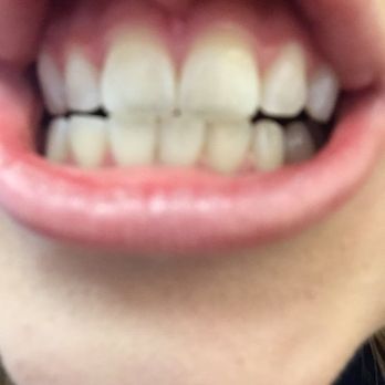 Dazzling Smile Dental Group - General Dentistry Near Me - Costa Mesa, California