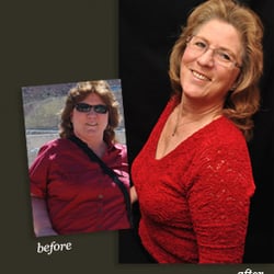 Dallas Bariatric Center - LAP-BAND® Patient