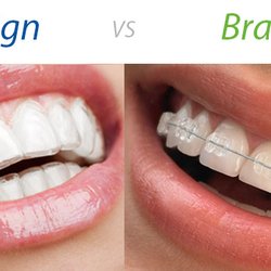 Centre Dental Office - We offer all orthodontic treatment