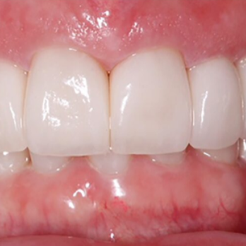 Oceanside Gentle Dentistry - General Dentistry Near Me - Pompano Beach, Florida Oceanside Gentle Dentistry - General Dentistry Near Me - Pompano Beach, Florida