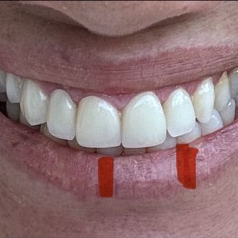 Naples Bay Dental Group - Dental Hygienists Near Me - Naples, Florida