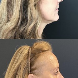 Renew Aesthetic & Laser Clinic