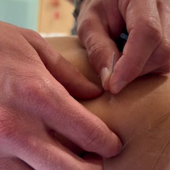 Samuel Audette Acupuncture LAc - Trigger Point Needling - Acupuncture Near Me - Culver City, California Samuel Audette Acupuncture LAc - Trigger Point Needling - Acupuncture Near Me - Culver City, California