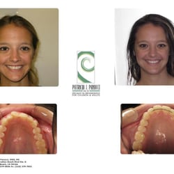 Patricia J Panucci, DMD MS - Beach Braces