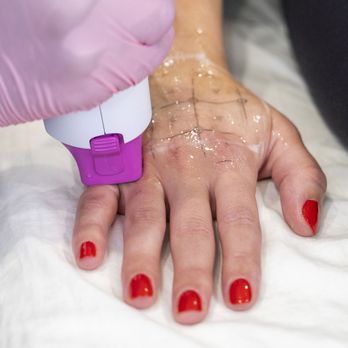 LaserAway - Tattoo Removal Near Me - Murray, Utah LaserAway - Tattoo Removal Near Me - Murray, Utah