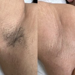 Dawn Rae Beauty - Underarm wax