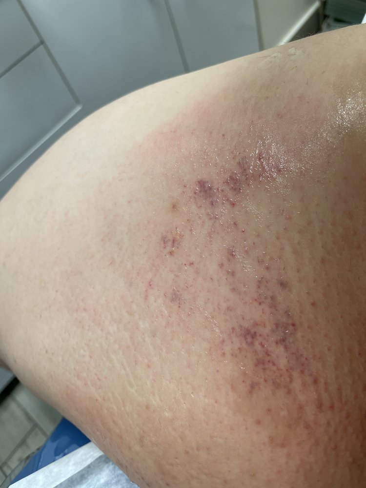 BRAZILIAN WAX BY ANDREIA 29 Photos & 14 Reviews 1565 Church St