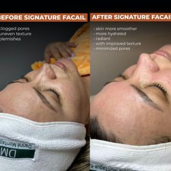 Ginger Sugaring - Signature Facial is a treatment service for you skin to make it looks younger and stunning