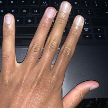 Young Nails & Spa - My cuticles when I did them at home myself - Nail Salons Near Me - Hamburg, New York