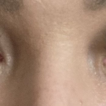 Johnny's Lashes - Both eyes are pink eyed after getting my eyelashes done by MAGGIE AT JOHNNYS EYELASH EXTENSIONS in Fontana off the ten fwy off Sierra - Eyelash Service Near Me - Fontana, California