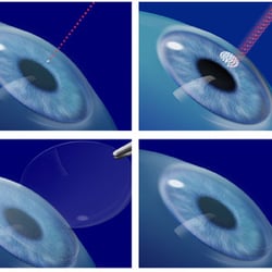 Hamilton Mill Eye Care