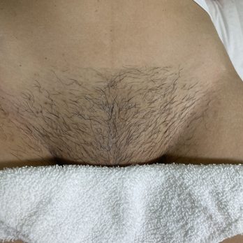 Giselle Esthetics - Before a Brazilian wax - Estheticians Near Me - Downey, California