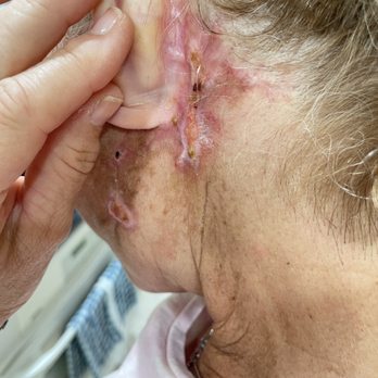 Ronald M. Warren, MD FACS - I can't make this up!! RUN from him!' - Cosmetic Surgeons Near Me - Marlton, New Jersey Ronald M. Warren, MD FACS - I can't make this up!! RUN from him!' - Cosmetic Surgeons Near Me - Marlton, New Jersey
