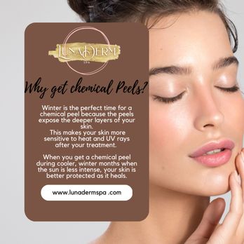 Lunadermspa - Why is it important to get chemical peels? - Skin Care Near Me - Downey , California Lunadermspa - Why is it important to get chemical peels? - Skin Care Near Me - Downey , California