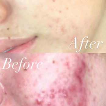 Aesthetics by Sandra Marino - Skin Care Near Me - San Jose, California Aesthetics by Sandra Marino - Skin Care Near Me - San Jose, California